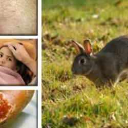 Tavşan ateşi vakalarında artış: Sonuçları ölümcül olabilir!