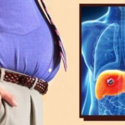 Karaciğer yağlanması karaciğer kanserine sebep oluyor!