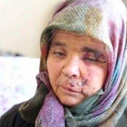 Kızlarına ziyarete giden yaşlı çifte köpekler saldırdı