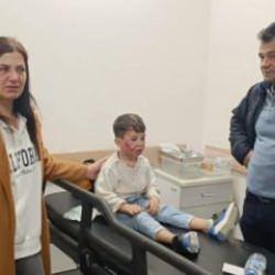 7 yaşındaki çocuk, oyun parkında başıboş köpeğin saldırısına uğradı