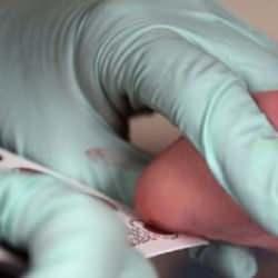 Bebeklerde topuk kanı alınmazsa ne olur? Topuk kanı zorunlu mu?