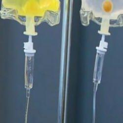 Can alan atomun arkasındaki tehlike! İşte sarı serumun &ouml;l&uuml;me s&uuml;r&uuml;kleyen nedenleri