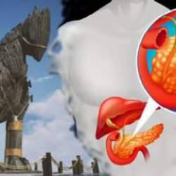 Pankreas kanseri tedavisinde Truva atı yöntemi: Umut vaat ediyor!