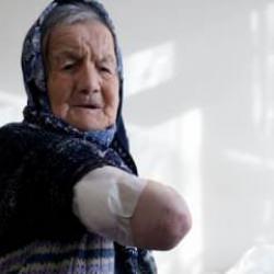 Ankara'da başıboş sokak k&ouml;peği yaşlı kadına saldırdı