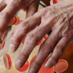 Etobur diyeti yan etkileri: Vücudunda sarı bezeler çıktı!