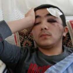 Isparta'da köpek dehşeti:16 yaşındaki Salih ölümden döndü! 