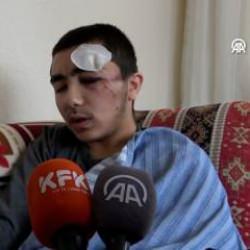 Isparta'da sahipsiz köpekler dehşet saçtı