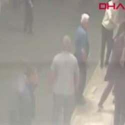 Dehşetin görüntüsü çıktı! Doktorun elinde bir tutam saçı kaldı!