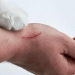 Kedi tırmığı hastalığı belirtileri: Kedi tırmığından ne olacak sanki deyip geçmeyin!