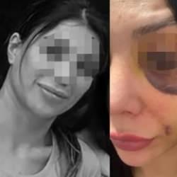 Lisanslı kick boks&ccedil;u iş arkadaşına dehşeti yaşattı! Y&uuml;z&uuml; tanınmayacak halde...