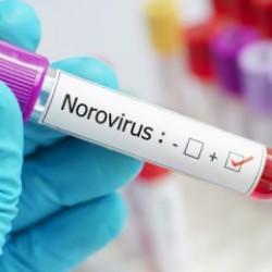 Uzmanından Norovirüs uyarısı! Bu belirtilerle karşılaşıyorsanız doktorun yolunu tutun