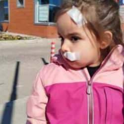 İzmir'de dehşet!  Sahipsiz köpek 3 yaşındaki Elif'e saldırdı