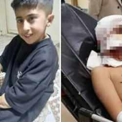 10 yaşındaki çocuk dehşeti yaşadı! Başıboş köpekler saldırdı