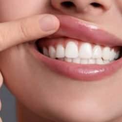 Diş &ccedil;&uuml;r&uuml;ğ&uuml; deyip ge&ccedil;meyin! ''Bağırsakta adeta yangın &ccedil;ıkarıyor'' diyerek herkesi uyardı