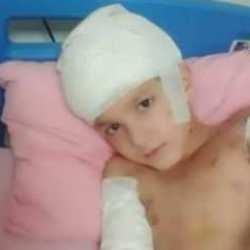 Köpek saldırısında bu hale gelmişti! Tunahan Yılmaz davasında karar çıktı