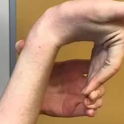 Saniyenizi alacak bu test hastalıkları ortaya &ccedil;ıkarıyor! Eğer aşırı esniyorsa&hellip;