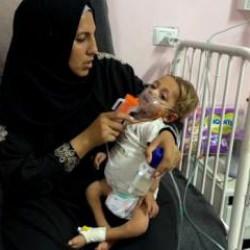 Gazze’de 3 Yaşındaki Hasan Barbah açlık ve abluka ile savaşıyor