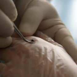 Kene kabusu geri döndü! Uzmanlardan yaz ayları için kritik uyarı