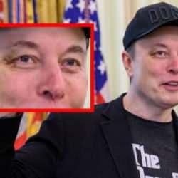 Sağ gözü neden mor? Elon Musk sebebini açıkladı