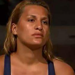 Survivor'dan sonra bı&ccedil;ak altına yatmıştı! Almeda'nın son hali hayrete d&uuml;ş&uuml;rd&uuml;