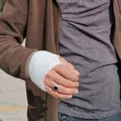 Bakan Memişoğlu a&ccedil;ıkladı: Bayramın ilk g&uuml;n&uuml;nde 14 binden fazla yaralı