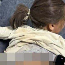 Sokak köpeği dehşeti! 7 yaşındaki Zeynep yaralandı