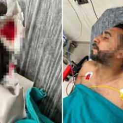 Adana'da d&ouml;ner ustası yorgun mermiyle başına isabet aldı