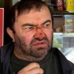 Bolu’da yüzde 90 engelli Murat Kepil akrabası tarafından darp edildi iddiası