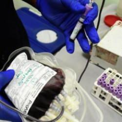 Dünyada bir ilk: 48. kan grubu "Gwada Negatif" keşfedildi!