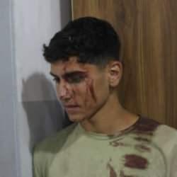 Bunun adı alçaklık! Yüzlerce kişi toplanmıştı, bomba yağdı!