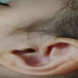 Parkta 3 yaşındaki çocuğun kulağına kene yapıştı