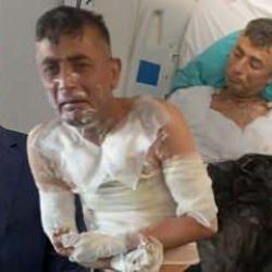 Engelli vatandaşın &uuml;zerine benzin d&ouml;kerek yaktı: Olayın her detay kan dondurdu...