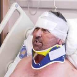 Aslan saldırısına uğrayan adamın son durumu belli oldu: Tam bir kara Murat