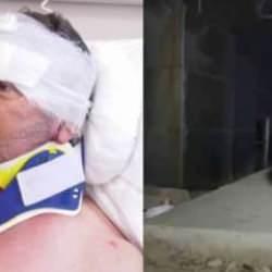 Aslanın saldırdığı &ccedil;ift&ccedil;i taburcu edildi: Hakkımı helal ederim