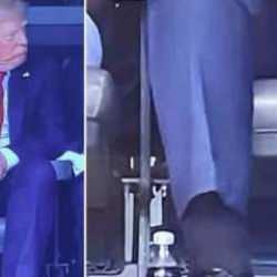 Beyaz Saray Trump'ın hastalığını açıkladı: Venöz yetmezlik