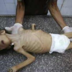 Bakan ürperten rakamı açıkladı! Dünya böylesini görmedi