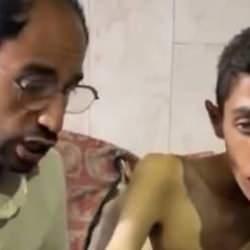 Gazze açlıktan ölüyor! Neredeyse her üç kişiden biri günlerdir hiçbir şey yemiyor