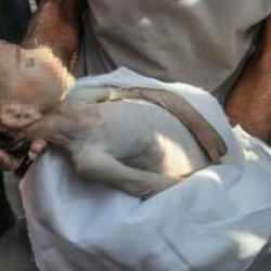 Gazze felaket boyutunda a&ccedil;lıkla karşı karşıya: &Ccedil;ocuklar a&ccedil;lıktan eriyor