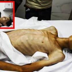 Gazze'de açlıktan şehit olanların sayısı 175'e çıktı