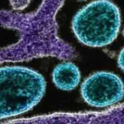 Gana'da M çiçeği alarmı! Virüs yayılmaya devam ediyor!