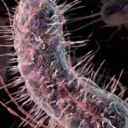 Et yiyen bakteri T&uuml;rkiye'de g&ouml;r&uuml;ld&uuml; m&uuml;? A&ccedil;ıklama geldi..