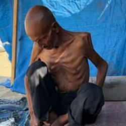 Gazzeli yaşlı adam, açlıktan 40 kiloya düştü