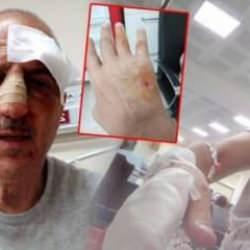 Önce icra yoluyla evinden tahliye edildi, ardından darp edildi