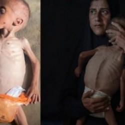 İsrail'in açlık silahı... Gazze'de 40 binden fazla bebek ölüm riskiyle karşı karşıya