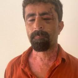 Damat dehşeti: Kayınpederini öldüresiye dövdü!