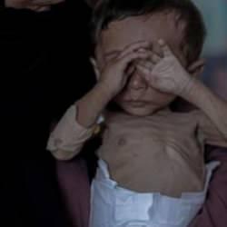 Gazze'den çıkış yok! Ya açlık ya da insani yardım pususu! 