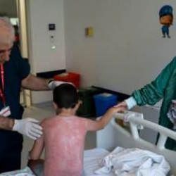 Güneşin altında 4 saat kalan çocuk, ikinci derece yanık oldu
