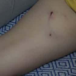 Rize’de başıboş köpek dehşeti! 5 yaşındaki çocuğu saldırdı