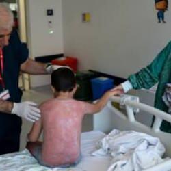 Tatilleri kâbusa döndü! 4 saat güneşte kalan çocuk, hastanelik oldu