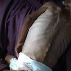 Gazze’de açlıktan 5 ölüm daha!